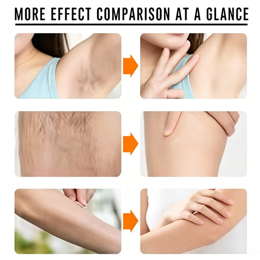 Facial Hair Removal Cream with Coconut Oil – Gentle, Non-Sticky | Upper Lip & Face