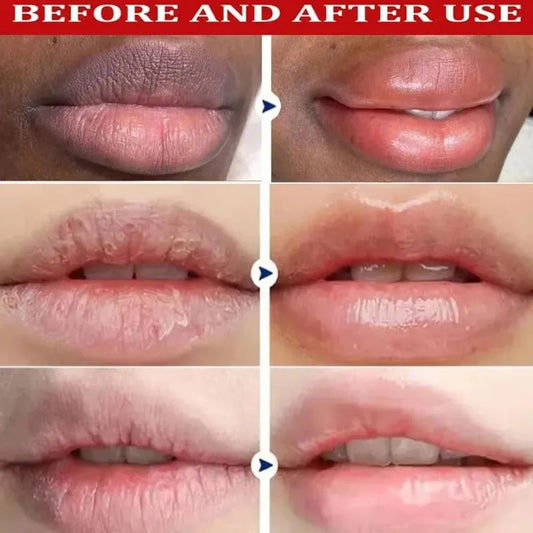 Remove Dark Lip Balm Lightening Melanin Mask Gloss Exfoliating Lip Pink Treatment Reduce Lip Lines Improve Dryness Moisturizing Cindorium