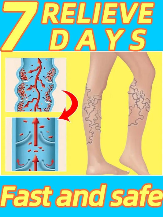Varicose and Spider Vein Cream - Cindorium